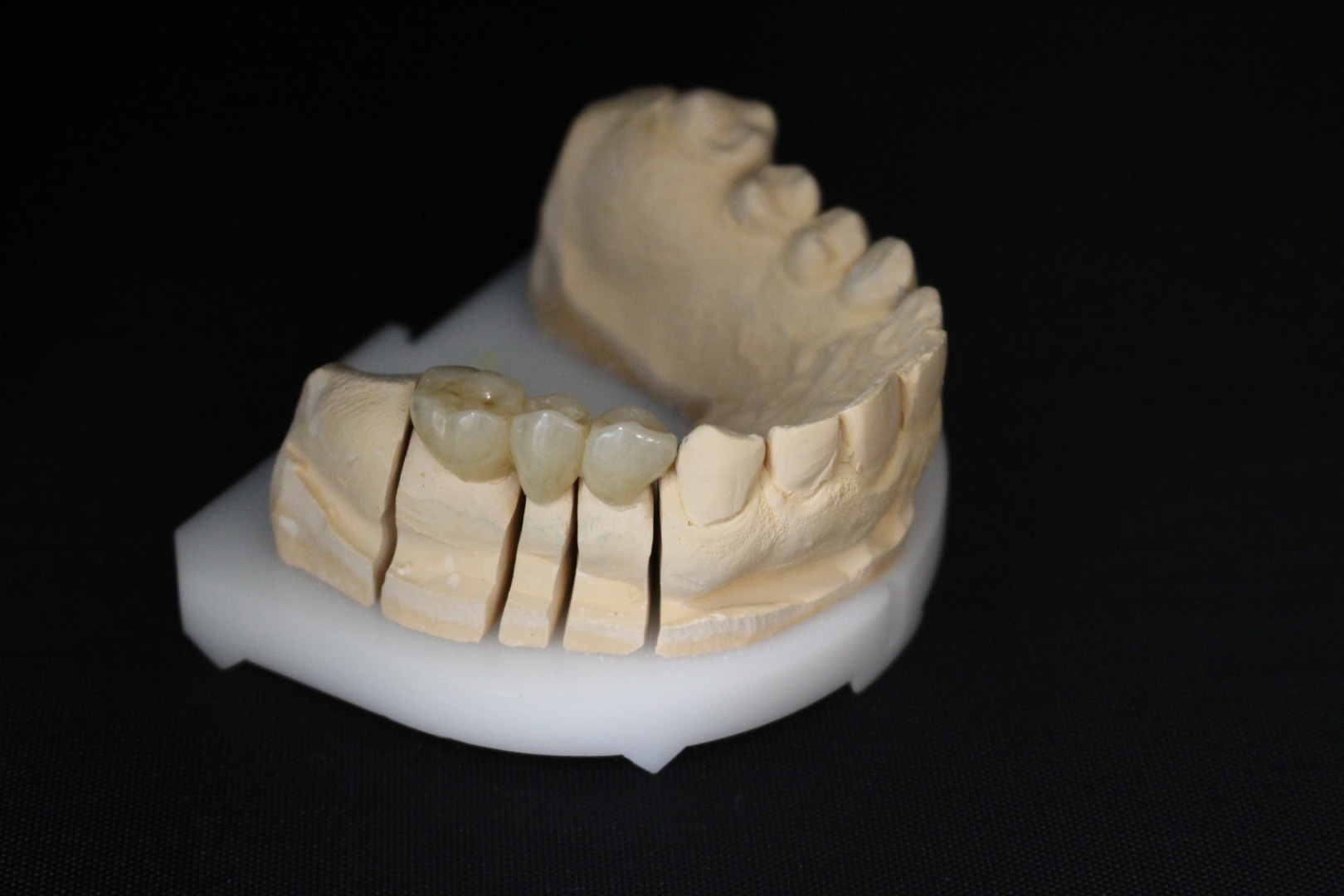 FIKSNI RADOVI - KRUNICE I MOSTOVI