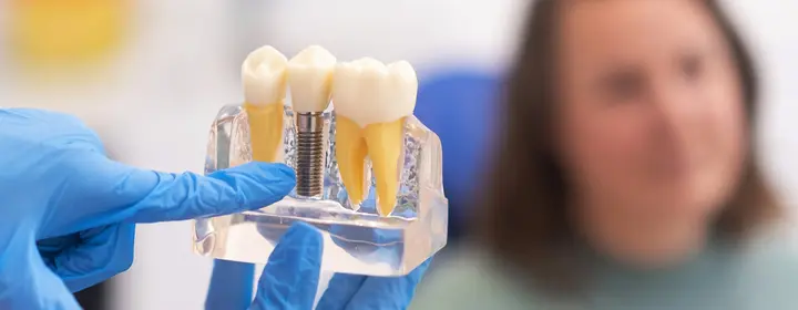 Implantology